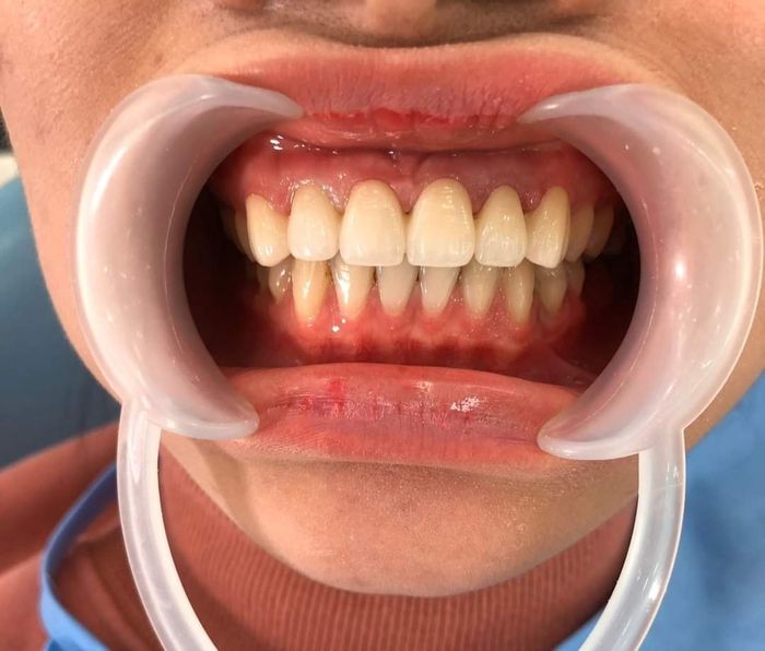 Hệ thống phòng điều trị đạt chuẩn tại Nha Khoa Lạng Sơn