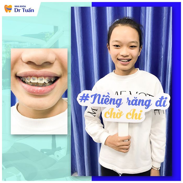 Hình ảnh tại Nha Khoa Dr. Tuấn Nhà Thờ