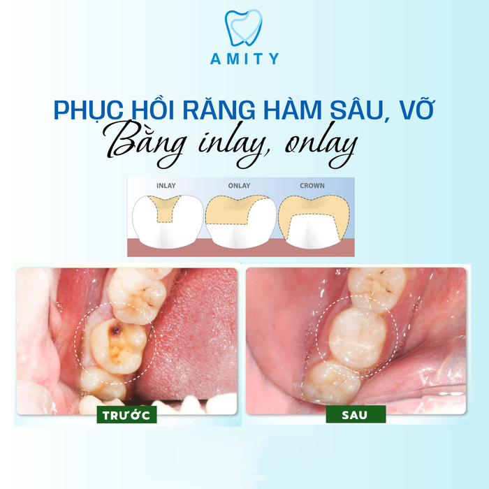 Đội ngũ bác sĩ chuyên môn cao tại Nha khoa Amity