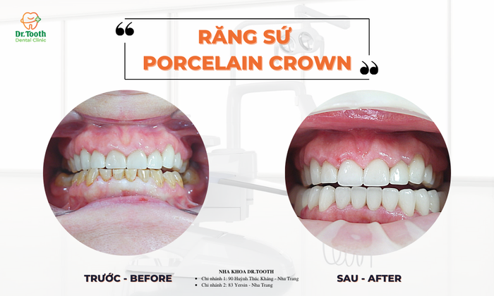 Hình ảnh không gian hiện đại tại Nha khoa Dr.Tooth