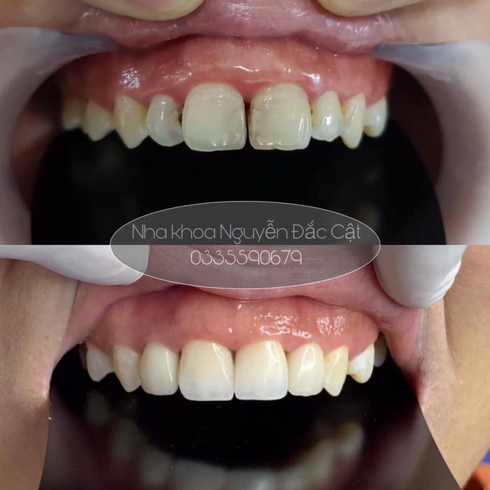 Không gian hiện đại và tiện nghi tại Nha khoa Nguyễn Đắc Cật
