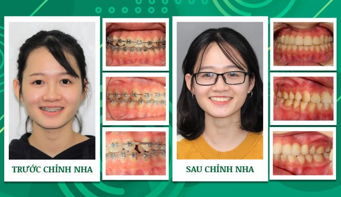 Hình ảnh Nha khoa Trẻ 1