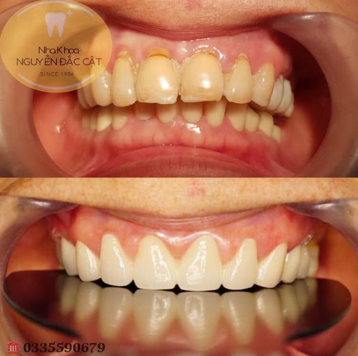 Hệ thống máy móc và trang thiết bị hiện đại tại Nha khoa Nguyễn Đắc Cật