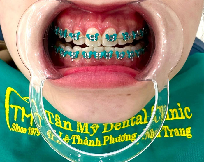 Không gian hiện đại và tiện nghi tại Nha khoa Tân Mỹ