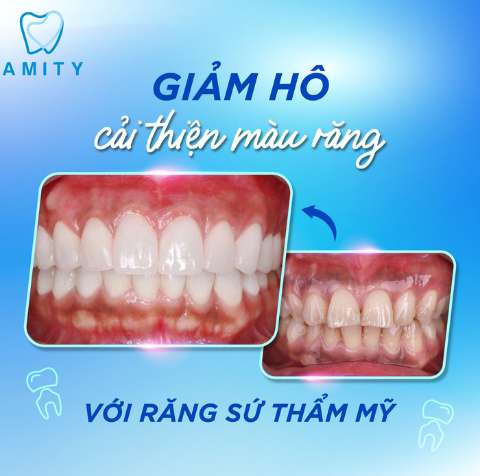 Không gian sang trọng và hệ thống máy móc hiện đại tại Nha khoa Amity