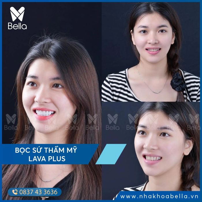 Ảnh minh họa Nha Khoa Bella 2