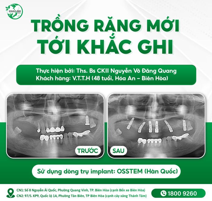 Hình ảnh 2 về Nha Khoa Quốc Tế Khắc Ghi - Môi trường vô trùng chuẩn quốc tế cùng đội ngũ bác sĩ giàu kinh nghiệm.