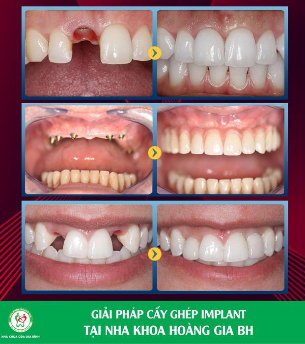 Không gian hiện đại và chuyên nghiệp tại Nha Khoa Hoàng Gia Biên Hòa