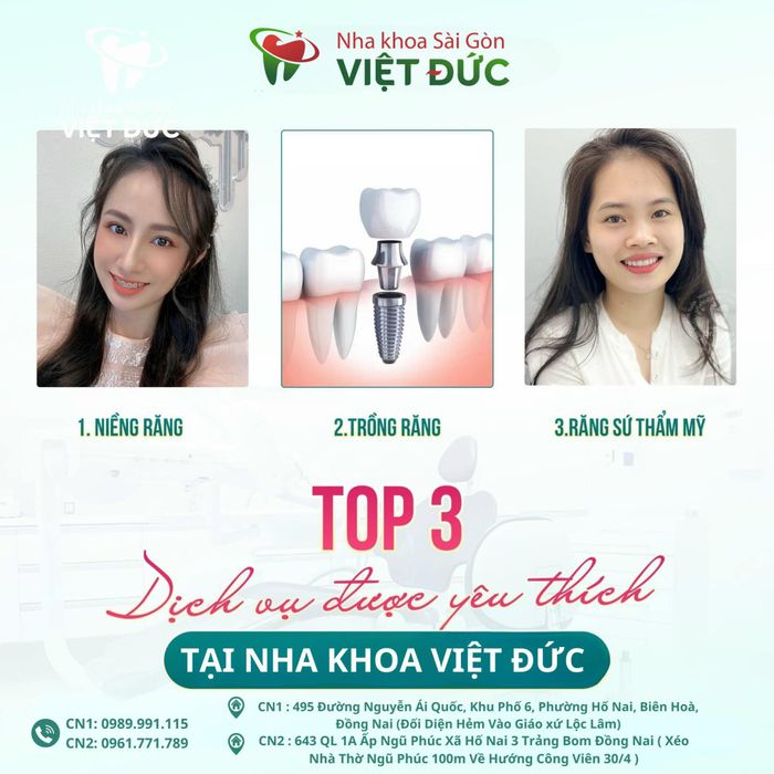 Quy trình trồng răng implant chuyên nghiệp tại Việt Đức