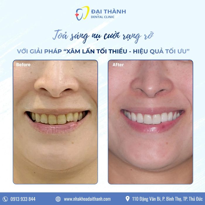 NHA KHOA ĐẠI THÀNH ảnh 2
