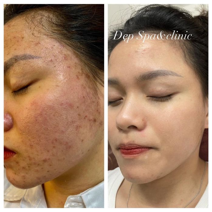 Đẹp Spa & Clinic ảnh 2
