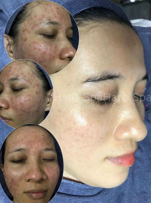 HANA SPA ảnh 2 - Không gian tinh tế nơi vẻ đẹp được tôn lên từng chi tiết