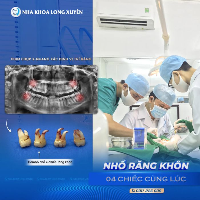 Không gian hiện đại và tiện nghi tại Hệ Thống Nha Khoa Long Xuyên - Ảnh 1