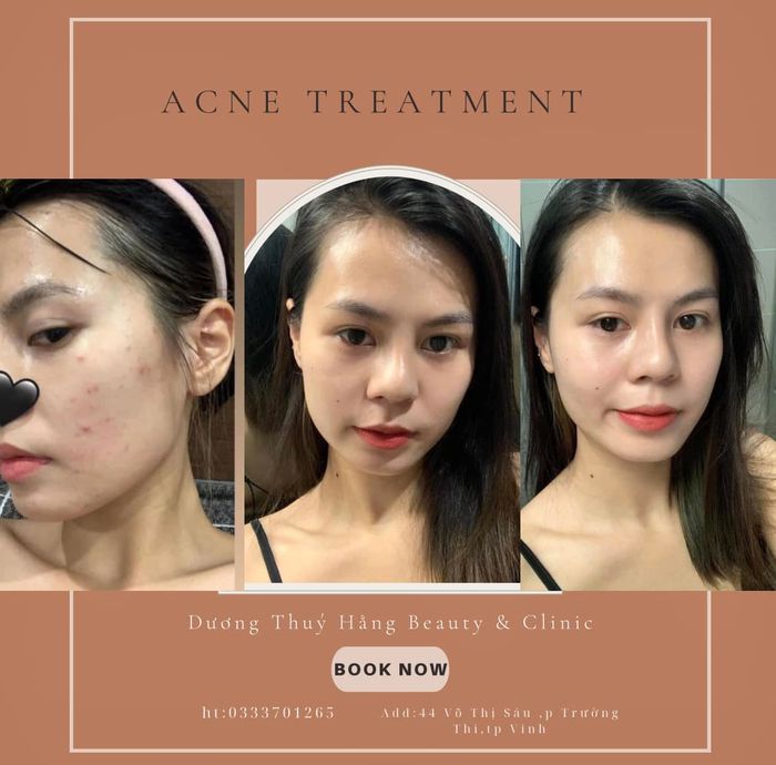 Dương Thuý Hằng Beauty and Clinic - Hình ảnh 2 chân thực về không gian sang trọng và dịch vụ chuyên nghiệp