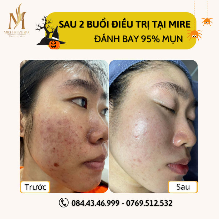 MiRe Home Spa - Kim Thiên Hoa Nha Trang ảnh 2