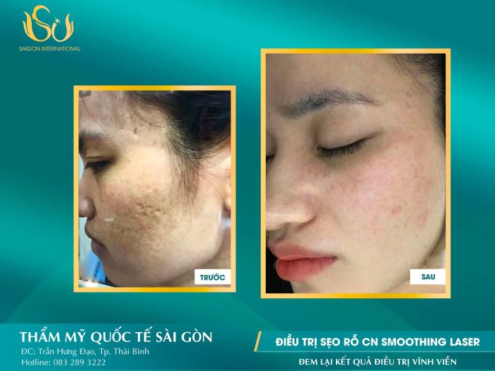 Thẩm Mỹ Quốc tế Sài Gòn ảnh 1