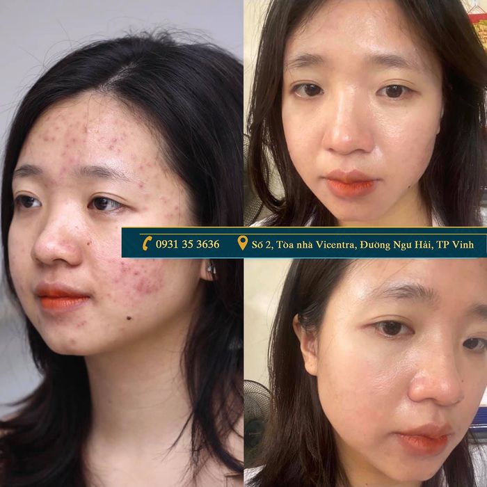 Viện Thẩm Mỹ Quốc Tế Thavi ảnh 1 - Không gian vàng cho những chuẩn mực làm đẹp hoàn hảo