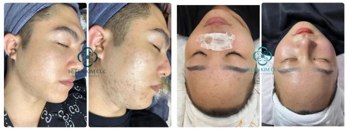Helen Kim Cúc Beauty Center ảnh 3