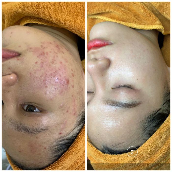 Hình ảnh Huyền Doll Beauty Center - Không gian trị liệu đạt chuẩn quốc tế