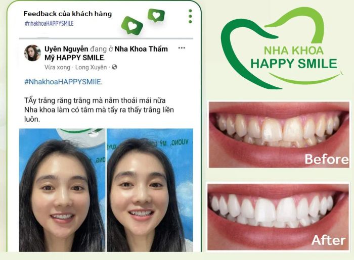 Hình ảnh không gian hiện đại và tiện nghi tại Nha Khoa Happy Smile