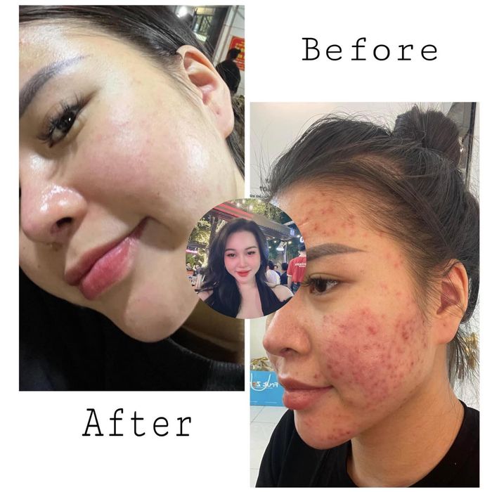 Hình ảnh Rose Spa - Không gian sang trọng đạt chuẩn 5 sao