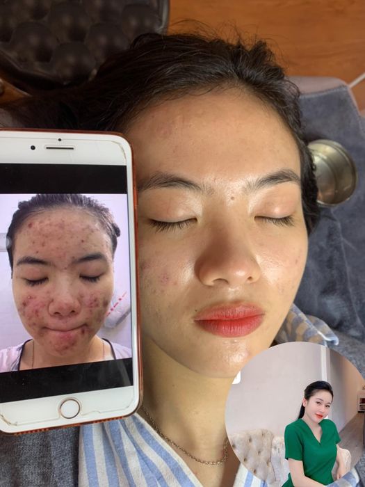 Hình ảnh Rose Spa - Quy trình trị liệu chuyên nghiệp