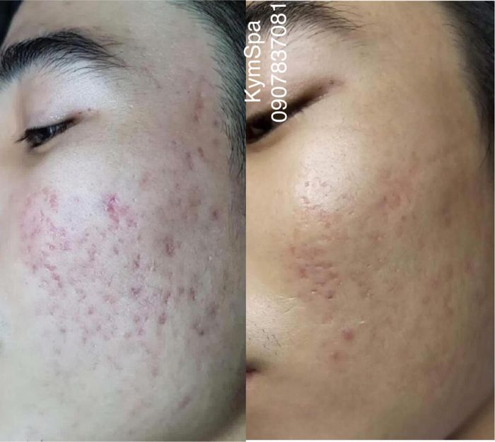 Không gian sang trọng và hiện đại tại Kym Spa