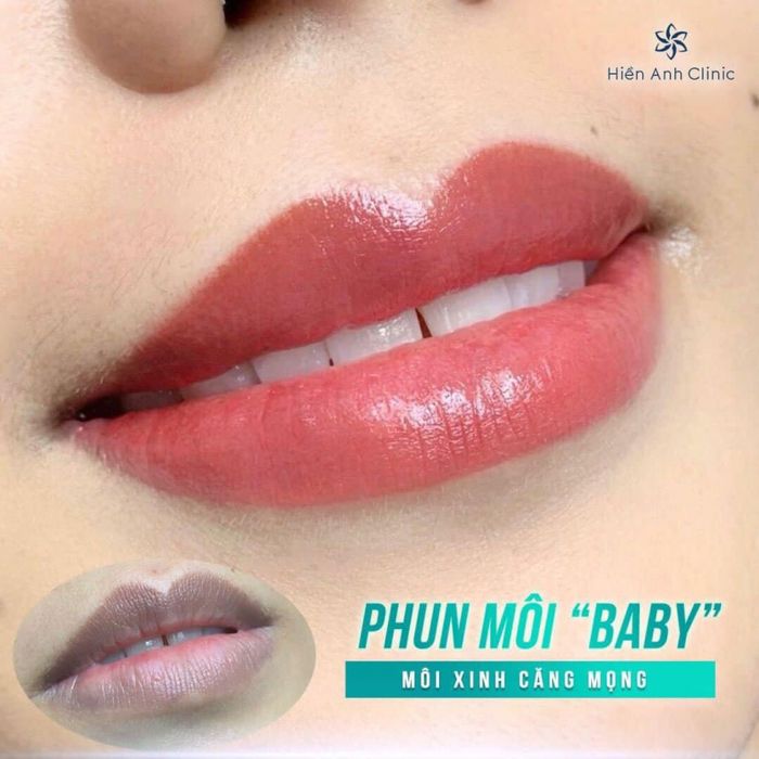 Không gian hiện đại tại Hiền Anh Clinic