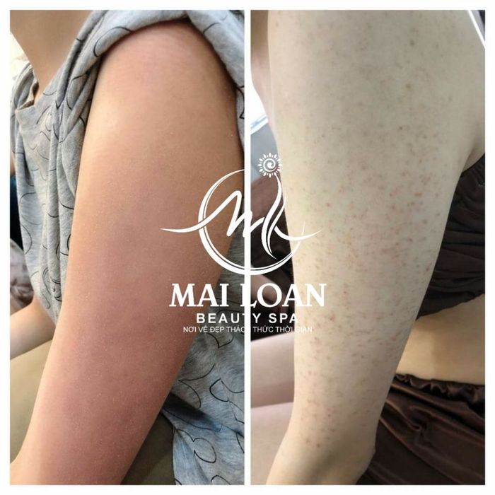 Quy trình chăm sóc da chuyên nghiệp tại Spa Mai Loan