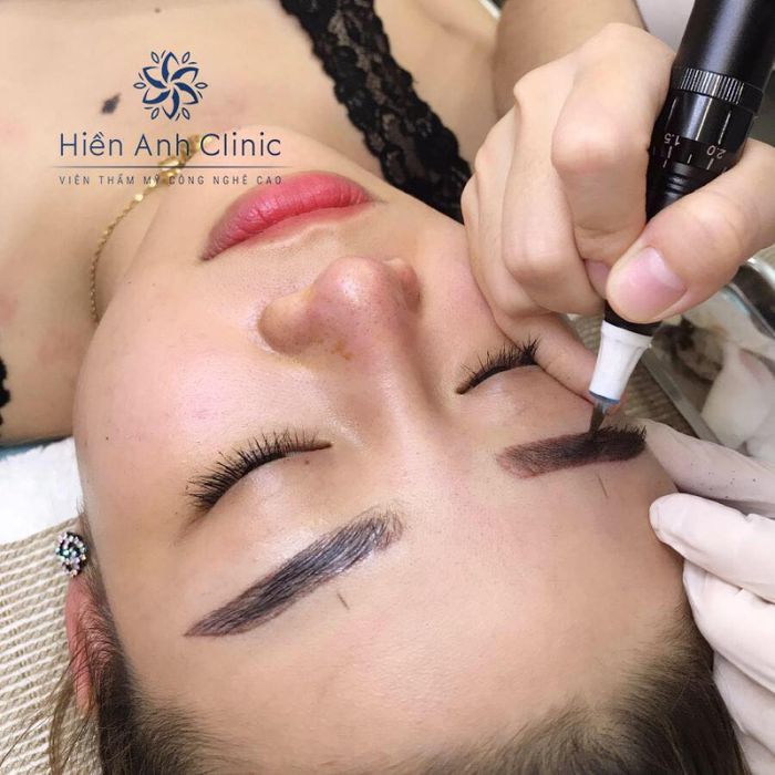 Hình ảnh thực tế dịch vụ tại Hiền Anh Clinic