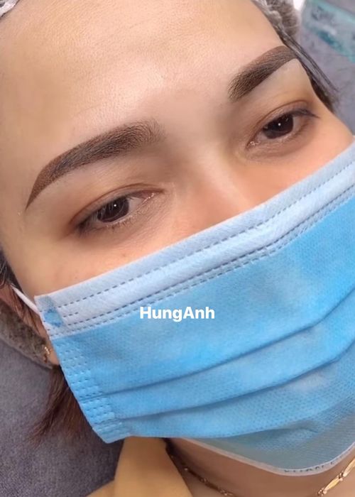 Thẩm mỹ Hùng Anh - Hình ảnh 2