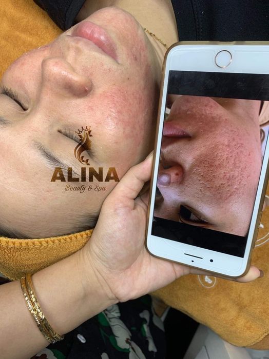 Hình ảnh không gian sang trọng tại ALINA Beauty & Spa