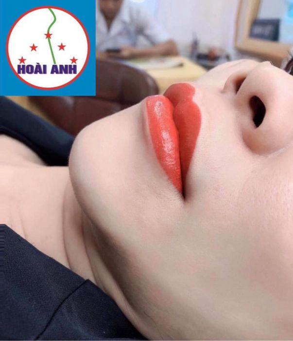 Kết quả phun xăm ấn tượng tại Thẩm Mỹ Viện Hoài Anh