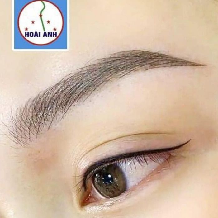 Hình ảnh thực tế dịch vụ tại Thẩm Mỹ Viện Hoài Anh