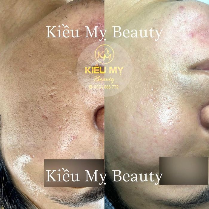 Không gian trị liệu sang trọng tại Kiều Mỵ Beauty & Academy