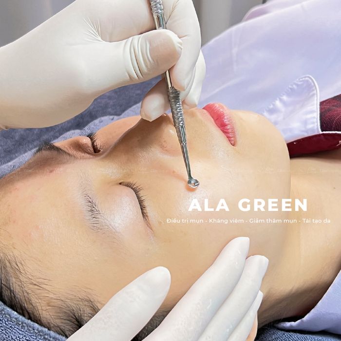 Cốm Beauty Spa - Quy trình trị mụn chuẩn y khoa với thảo dược quý