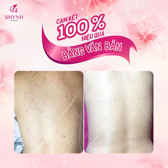 Shynh House 2 - không gian hoàn hảo để bạn thư giãn, tận hưởng sự chăm sóc tận tâm và chuyên nghiệp. Nơi đây mang đến những trải nghiệm đẳng cấp cho mọi khách hàng.