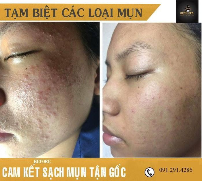 Been Spa - Không gian sang trọng với hệ thống máy móc hiện đại