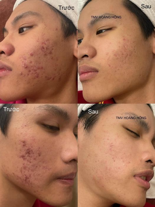 Hình ảnh Thẩm Mỹ Viện Hoàng Hồng Ninh Bình 2