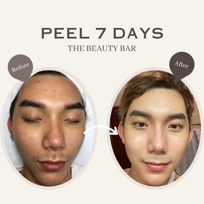 The Beauty Bar - Không gian trị liệu sang trọng đạt chuẩn quốc tế