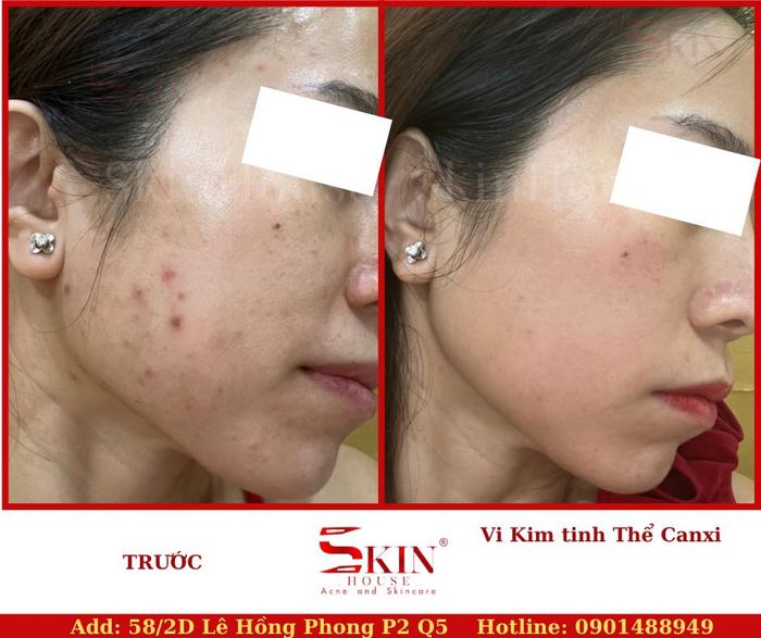 Skin House - Không gian trị liệu hiện đại với công nghệ tiên tiến