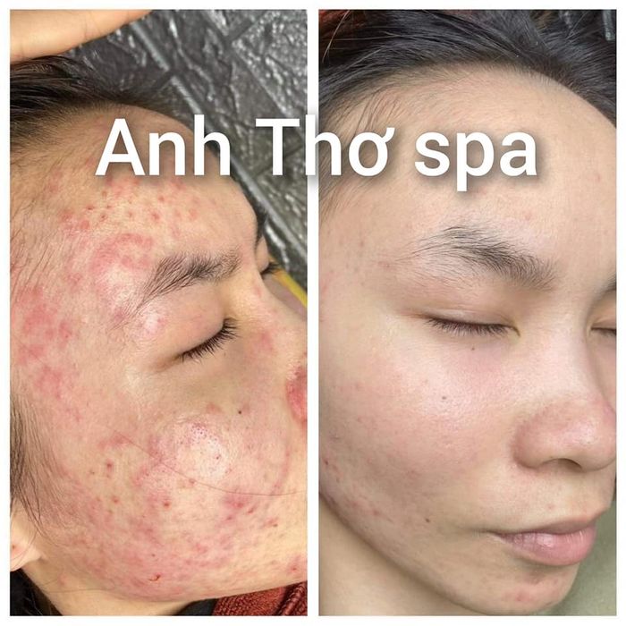Hình ảnh Anh Thơ Spa 1