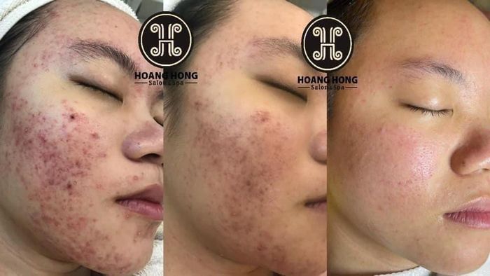 Hình ảnh Thẩm Mỹ Viện Hoàng Hồng Ninh Bình 1