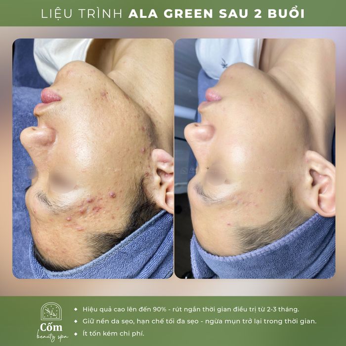 Cốm Beauty Spa - Không gian trị liệu sang trọng với công nghệ hiện đại