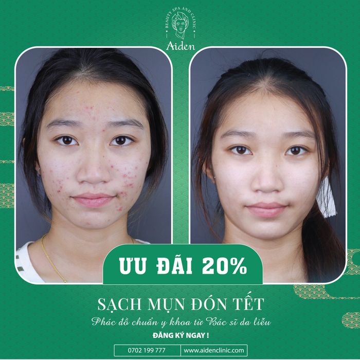 Aiden Beauty Spa & Clinic - Không gian trị liệu sang trọng đạt chuẩn y khoa