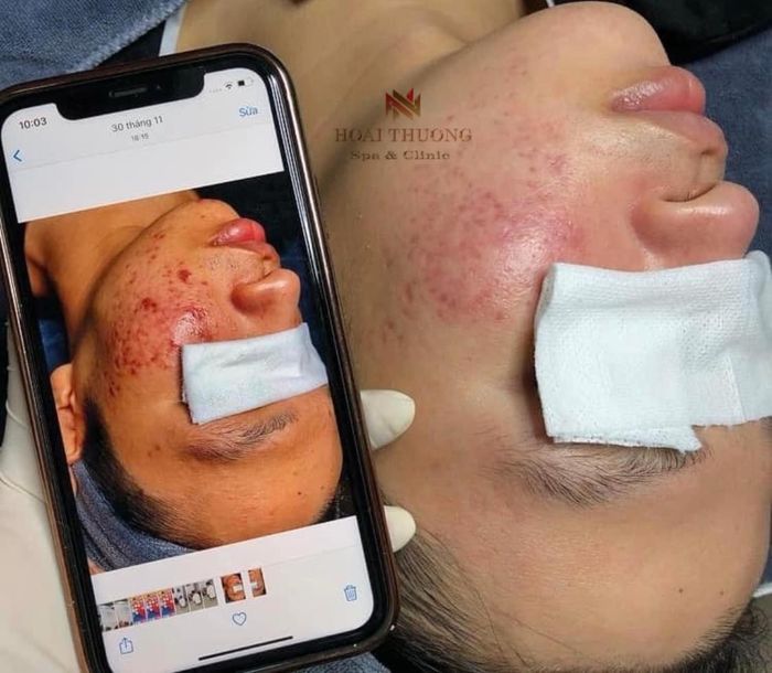 Hình ảnh Hoài Thương Spa 2