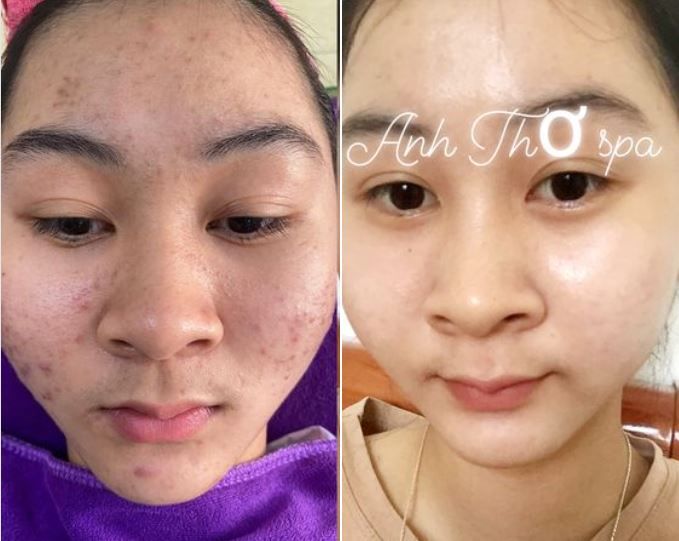 Hình ảnh Anh Thơ Spa 2