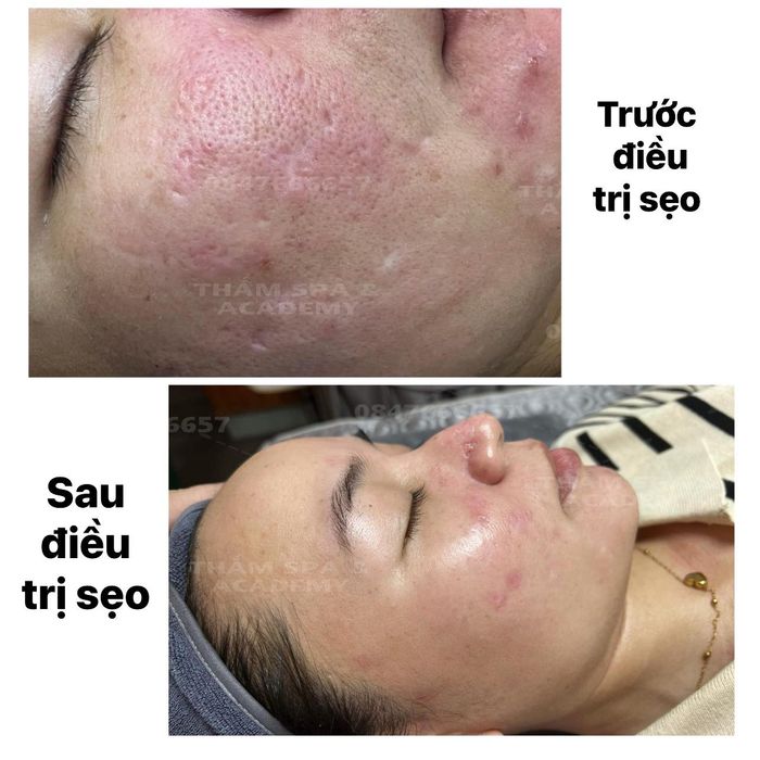 THẮM SPA & ACADEMY hình ảnh 1