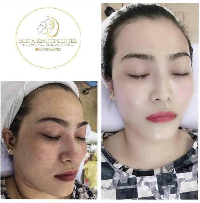 Không gian sang trọng tại Hi Spa Vũng Tàu