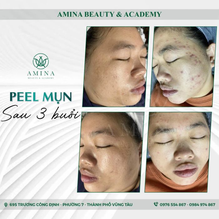 Không gian sang trọng đạt chuẩn y tế tại Viện Thẩm Mỹ AMINA